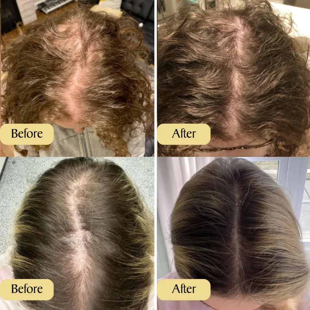 ??Your Natural Oil Treatment for Hair Growth