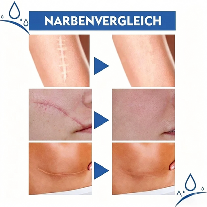 Narbenpflegecreme