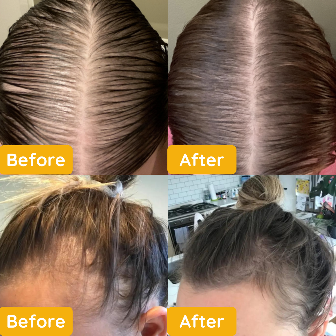 ??Your Natural Oil Treatment for Hair Growth